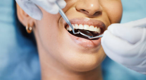 Best Emergency Denture Repair in Gonzales, CA