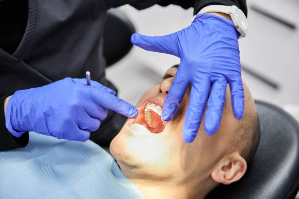 Best Urgent Care for Lost Fillings or Crowns in Gonzales, CA